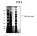 Fig. 04 - Expression of soluble, active eukaryotic glycosyltransferases in prokaryotic organisms