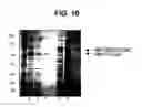 Fig. 11 - Expression of soluble, active eukaryotic glycosyltransferases in prokaryotic organisms