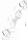 Fig. 07 - Power transmission cable