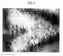 Fig. 04 - Three-dimensional nonwoven fabric with improved loft and resiliancy
