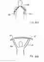 Fig. 06 - Method and apparatus for torso muscle lengthening