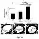 Fig. 03 - Methods for improving the structure and function of arterioles