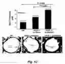 Fig. 04 - Methods for improving the structure and function of arterioles