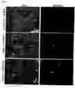 Fig. 02 - Method of reversing epithelial mesenchymal transition