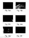 Fig. 16 - Peptides directed for diagnosis and treatment of amyloid-associated disease