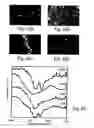 Fig. 19 - Peptides directed for diagnosis and treatment of amyloid-associated disease