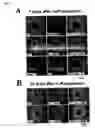 Fig. 03 - Compositions and methods for inhibiting inflammation of vessel walls and formation of neointimal hyperplasia