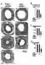 Fig. 04 - Compositions and methods for inhibiting inflammation of vessel walls and formation of neointimal hyperplasia