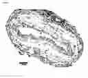 Fig. 06 - Compositions and methods for inhibiting inflammation of vessel walls and formation of neointimal hyperplasia