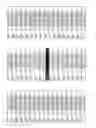 Fig. 10 - Methods and compositions for the treatment of eye disorders with increased intraocular pressure