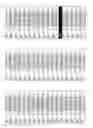 Fig. 16 - Methods and compositions for the treatment of eye disorders with increased intraocular pressure