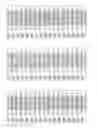 Fig. 28 - Methods and compositions for the treatment of eye disorders with increased intraocular pressure