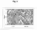Fig. 04 - Compositions and methods for reducing the risk of epileptic occurrence and/or for treatment of seizure disorders