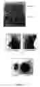 Fig. 04 - Novel compounds for treatment of cancer and disorders associated with angiogenesis function