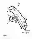 Fig. 06 - Diverticular remodling technique