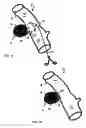 Fig. 07 - Diverticular remodling technique