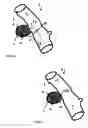 Fig. 08 - Diverticular remodling technique