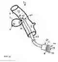 Fig. 09 - Diverticular remodling technique