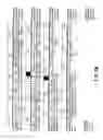 Fig. 10 - Galanin receptor 2 proteins and nucleic acids