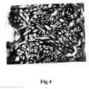 Fig. 05 - Process for preparing porous collagen matrix from connective tissue