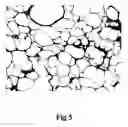Fig. 06 - Process for preparing porous collagen matrix from connective tissue