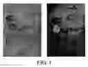 Fig. 02 - Antibodies against lesion tissue