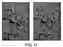 Fig. 12 - Antibodies against lesion tissue