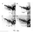 Fig. 13 - Tetrafluorobenzyl derivatives and pharmaceutical composition for preventing and treating acute and chronic neurodegenerative diseases in central nervous system containing the same