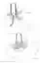 Fig. 03 - Method for treating tissue with an implant