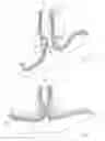 Fig. 04 - Method for treating tissue with an implant