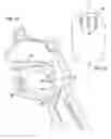 Fig. 08 - Implant for tongue