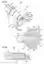 Fig. 15 - Implant for tongue