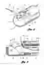 Fig. 04 - Endoscopic apparatus having an improved elevator