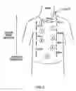 Fig. 03 - Method for in vivo sensing