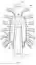 Fig. 06 - Apparatus and method for expanding a chest cavity
