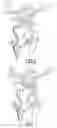 Fig. 06 - Apparatus and method for navigating an instrument through an anatomical structure