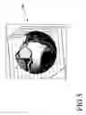 Fig. 06 - Mapping the coronary arteries on a sphere
