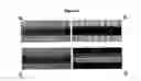 Fig. 05 - Contrast enhanced x-ray phase imaging