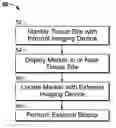 Fig. 01 - Internal biopsy marking