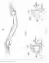 Fig. 12 - Apparatus and method for intravascular imaging