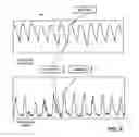 Fig. 16 - System and method for applying continuous positive airway pressure