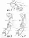 Fig. 03 - Reflex hammer