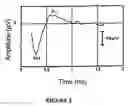 Fig. 03 - Parametric fitting of a cochlear implant