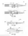 Fig. 03 - Apparatus and methods for material capture and removal
