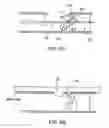 Fig. 06 - Apparatus and methods for material capture and removal
