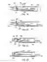 Fig. 12 - Apparatus and methods for material capture and removal