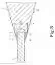 Fig. 06 - Guide wire