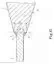 Fig. 07 - Guide wire