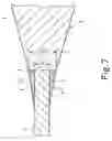 Fig. 08 - Guide wire