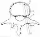 Fig. 01 - System and methods for improved access to vertebral bodies for kyphoplasty, vertebroplasty, vertebral body biopsy or screw placement